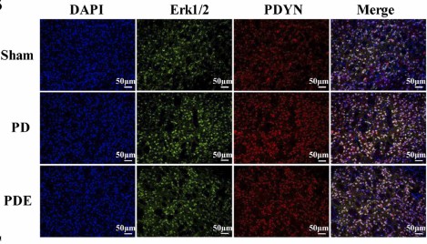 Schematic diagram of Erk1_2 and PDYN immunofluorescence double-labeling, PDYN immunofluorescence (red).jpg